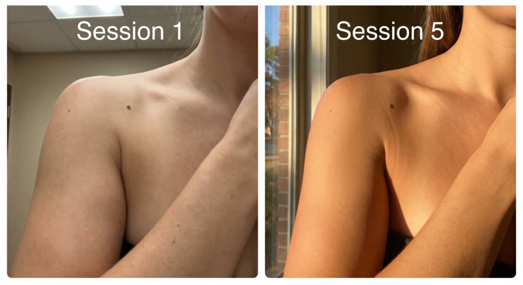 Visible tan buildup from session one to session five with That's What Sea Said accelerator